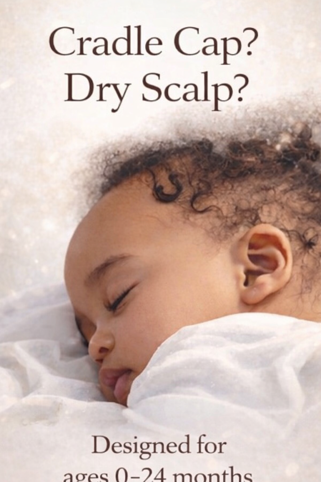Baby Bloom— Cradle Cap & Scalp Prep Oil Baby Hair Oil | Ages 0-24 months