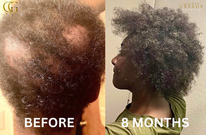 Melanin Miracle™ 
Hair Density & Growth Elixir
