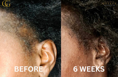 Melanin Miracle™ 
Hair Density & Growth Elixir